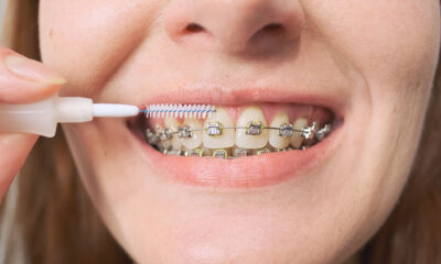 Woman brushes her teeth with braces using a toothbrush. Gentle cleaning of the teeth. Close-up, front view. High quality photo